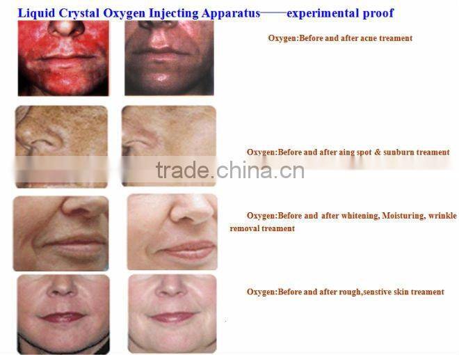 almighty oxygen jet Beauty Equipment