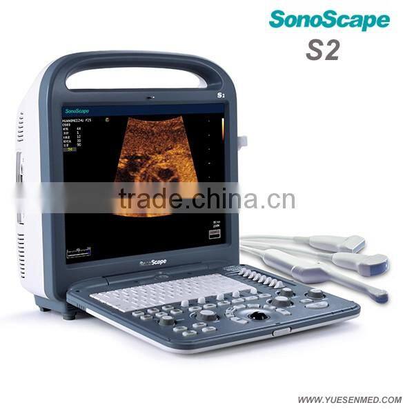 Mobile color Doppler system 3D 4D S11 Sonoscape echography