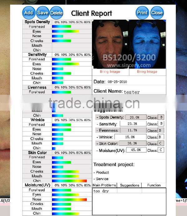 Newest 3D magic mirror skin analysis software