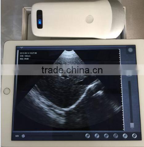 Best Price Pocket Ultrasonic Diagnostic Wireless Ultrasound Probe 10 Years Export Experience Supplier -WBU01