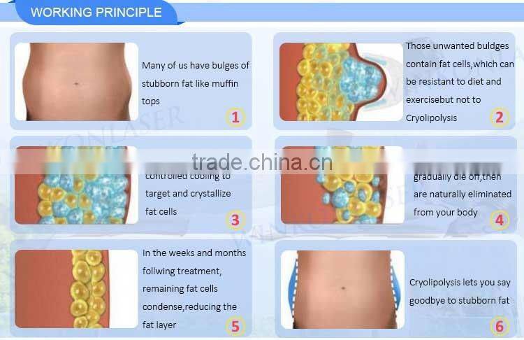 cryolipolysie / price cryolipolysis / cryolipolysis machine 2016