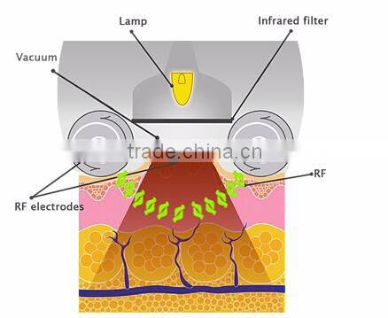 KUMA SHAPE III Vela Slim/Kuma shape/ Best Body Cavitation Vacuum Shaping Machine