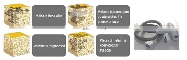 beauty ipl 2014 cheapest ipl machine price/multifunction laser beauty machine/shr ipl rf machine YH-III