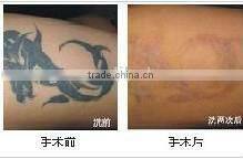 BFP-4000 Professional 3IN1 multi functional IPL machine