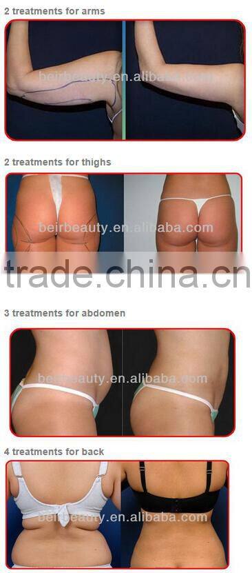 stationary lipolaser 528 Diode Fat Removal Cryo Lipolaser Beauty Machine