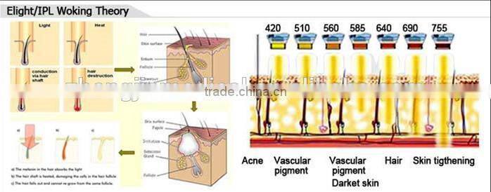 skin cleansing device Q-switched ND YAG laser tattoo removal laser for sale
