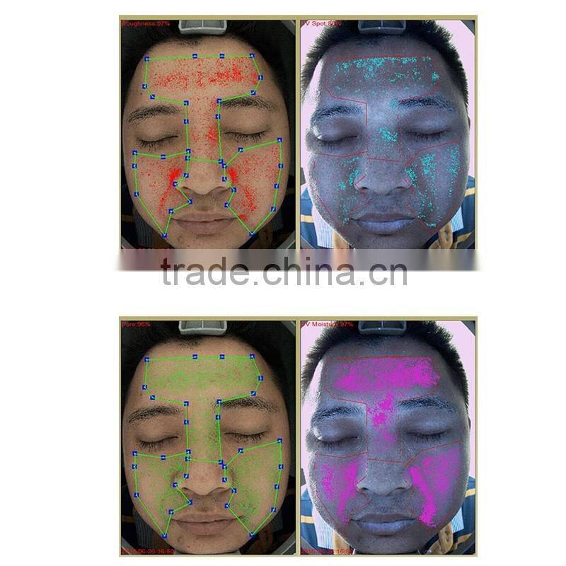 new technology face skin test machine/skin analysis machine