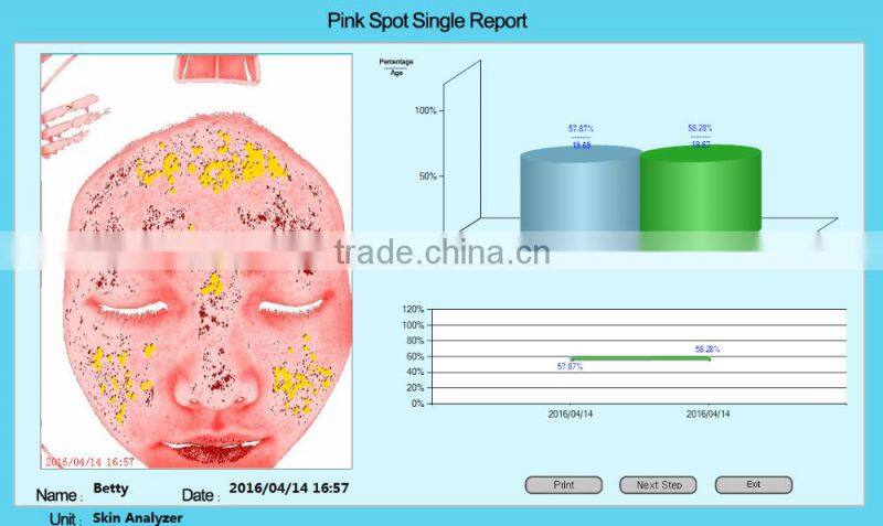 Factory direct sale 3d magic mirror skin analyzer portable type facial skin test machine