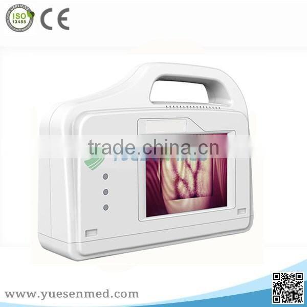 YSVV200 Good quality medical mobile simple operation vein light finder for sale