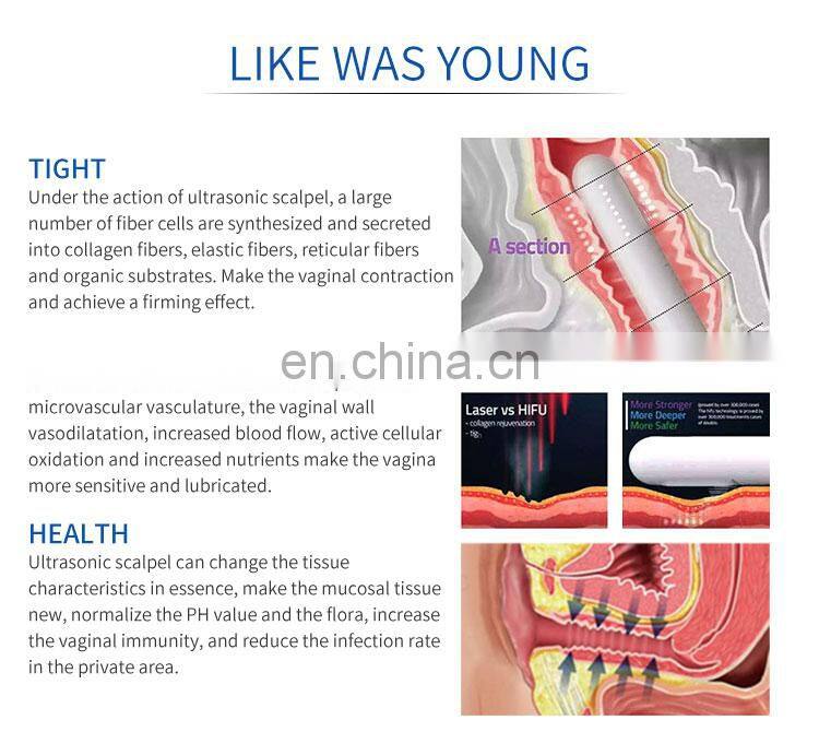 High Effective Hifu Vaginal Tightening Treatment Beauty Machine For Easy Use