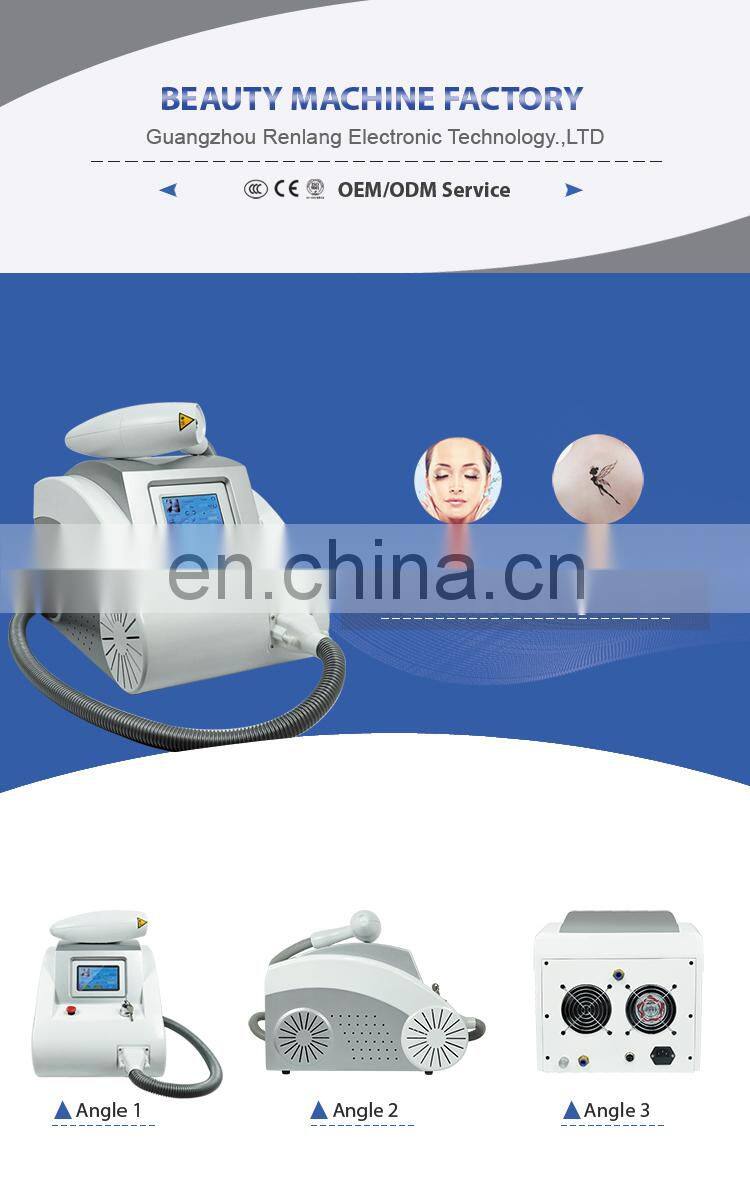 Carbon peel laser tattoo removal Q switch nd yag laser machine price