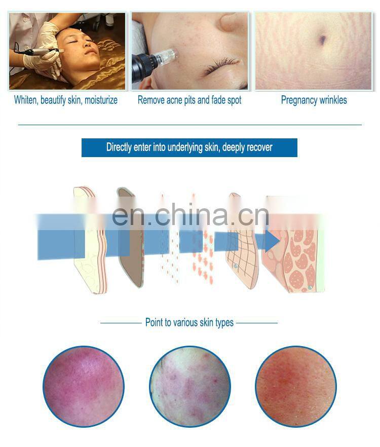 Professional A7 Derma Pen portable Microneedle Auto Derma Dr.Pen anti aging Skin Lifting Beauty Equipment