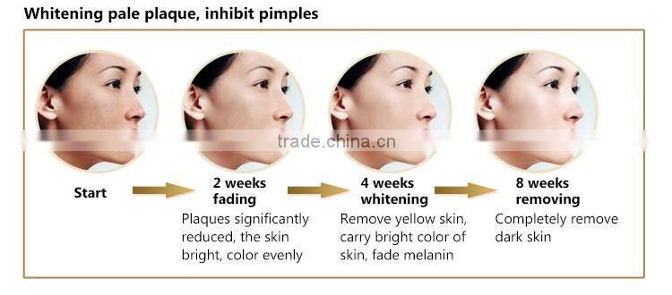 New Product body skin peeling solution facial exercise machines