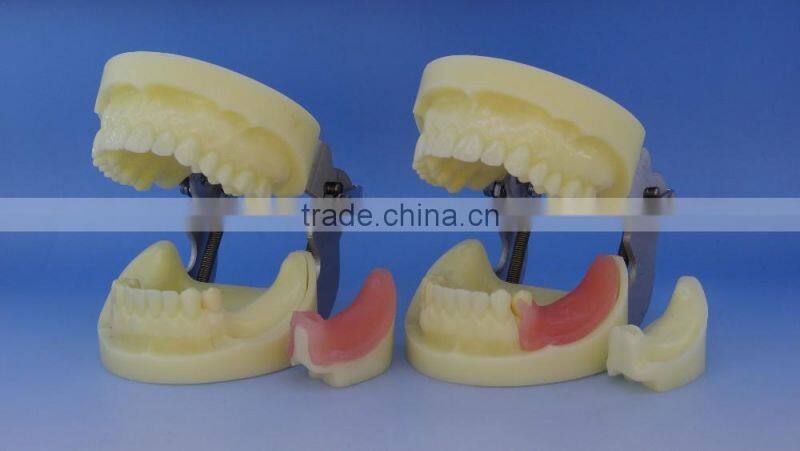 Dental Implant Practice Model DEA-31 Teeth Implant Models