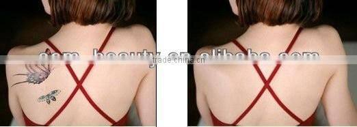 2016 New Product New Technology laser tattoo removal machine