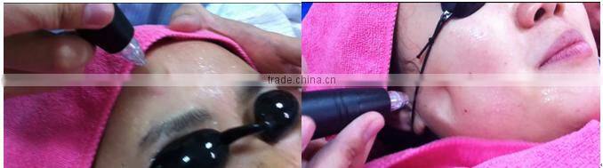 Good effective Jet peel water oxygen skin rejuvenation and acne removal machine