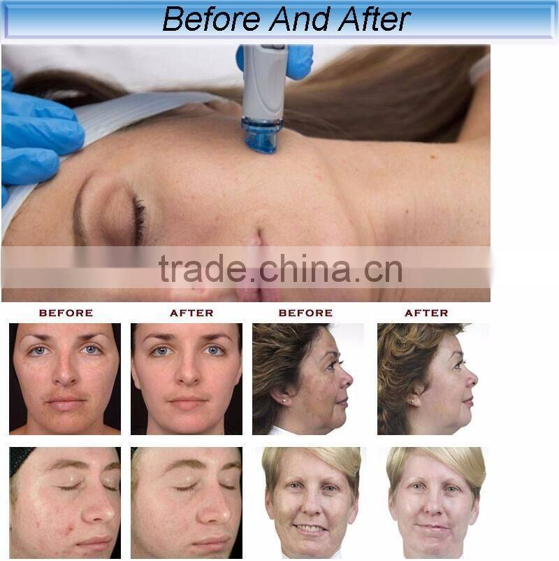 Multifunctional safe beauty machine hydro dermabrasion/microdermabrasion machine