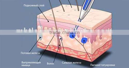 1064 nm 532nm 1032nm 1200W q-switch nd:yag laser / laser machine prices eyebrow washing laser laser tattoo removal