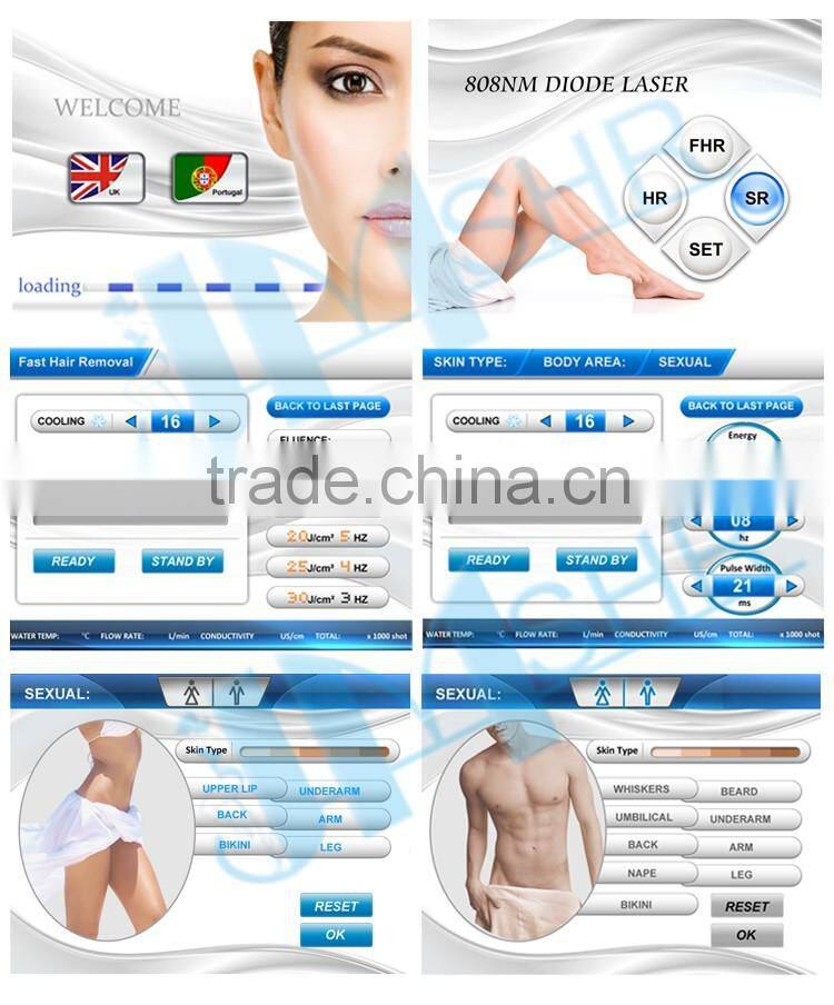 Hot sale 808nm Diode Laser Depilation Upper Lip Hair Removal Machine