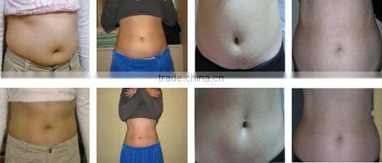 UK distributor wanted cavitation rf, fast cavitation slimming system, cavitation machine price