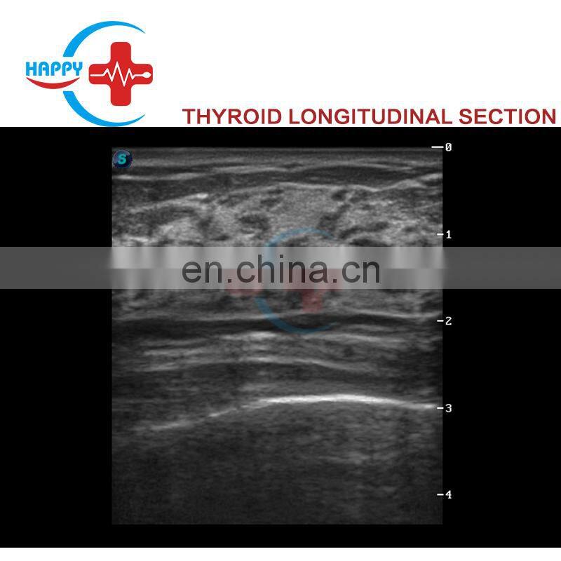 Sonoscape S30 best 3D/4D color doppler trolley ultrasound machine price/Sonoscape S30