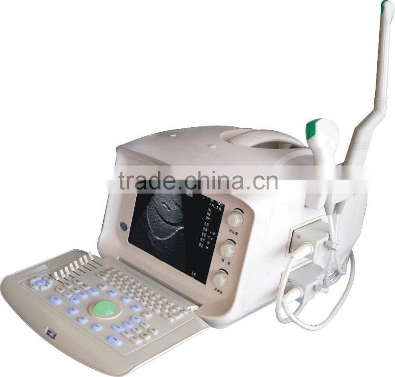 2015 Hot Selling Veterinary Digital Ultrasound Scanner