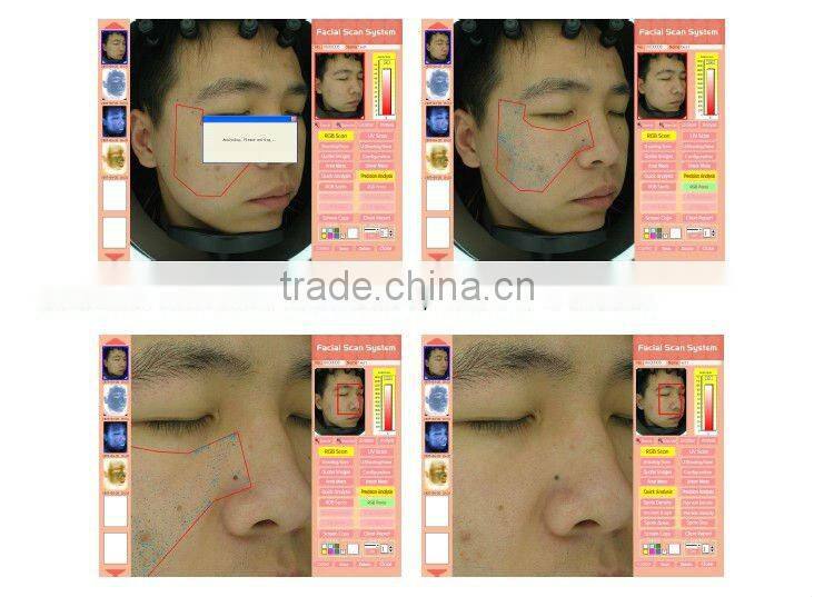 2012 Magic Mirror System/Skin analyser equipment