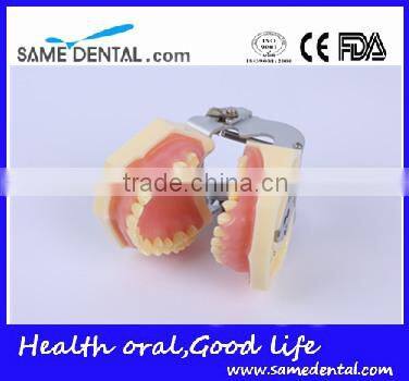 Dental Moderate Periodontal Disease Model Teaching Demonstration
