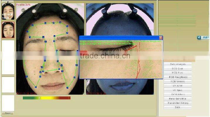 Magic Mirror Face Analyzer skin analysis machine J006
