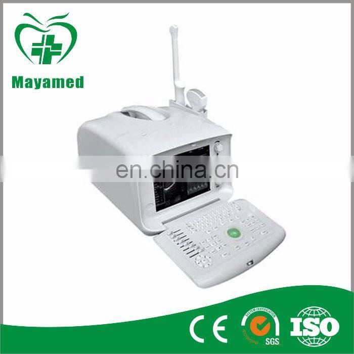 MY-A001A Laptop full digital portable ultrasound scanner mini ultrasound machine