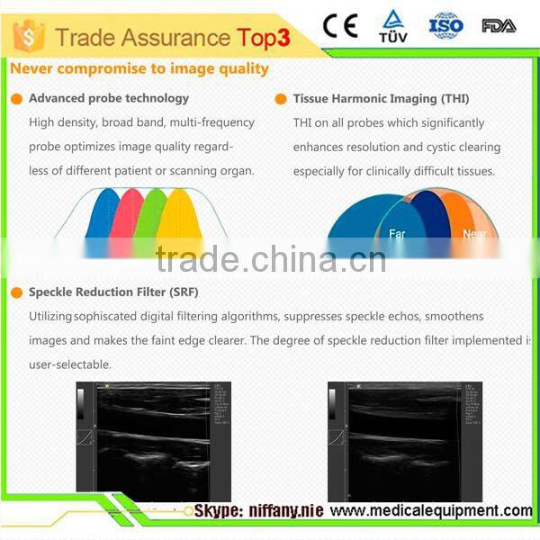 Coupon available! Ipad ultrasound scanner, touch screen scanner 3D color doppler MSLCU22-N