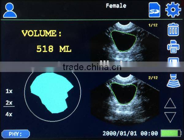 CareScan-1 Bladder Scanner Diagonosis Portable Scanner
