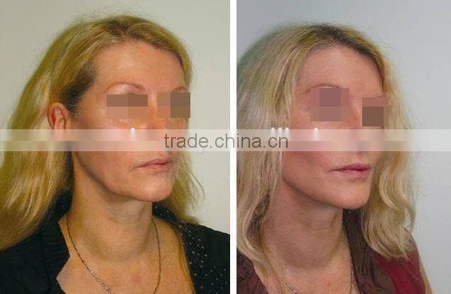 Portable 2 in 1 Oxygen Injection and spray therapy facial machines for home use skin tightening