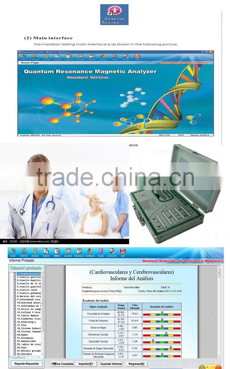 Doctor venation hand Acupuncture quantum bio-electric 3d nls body analyzer