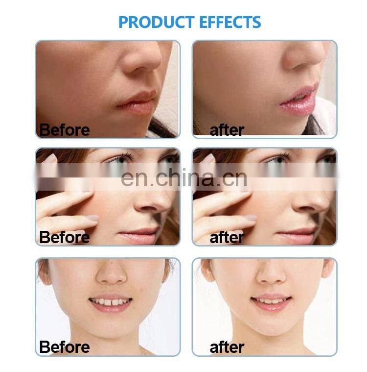 Skin Iron Radio Wave Skin Tightening Microcurrent Face & Body Lifting Device Powerful Lifting Beauty Instrument