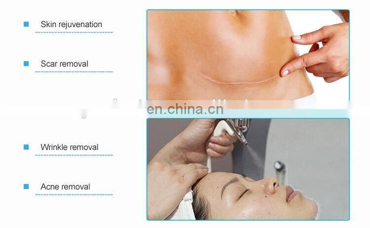 Portable oxygen jet peel water beauty machine oxygen spray machine for facial moisturizing