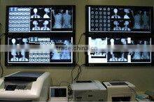 kodak film wholesale,x-ray mobile,tone tube