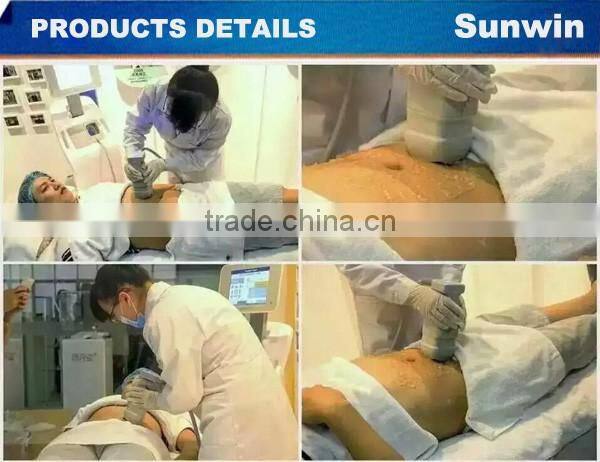 Portable non-surgical liposonix high intesity foucused ultrasound body slimming portable HIFU slimming