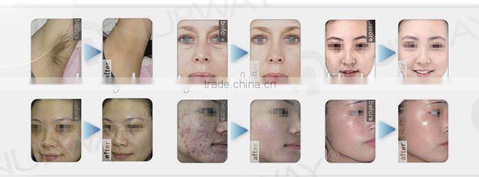 in-motion technology, ipl/shr/laser hair removal & skin rejuvenation machine