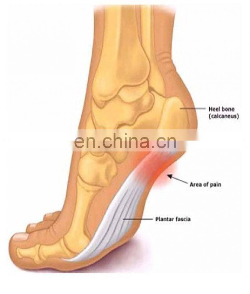 Plantar Fasciitis Wraps Arch Cushion and Support with Gel Therapy #JZ0007