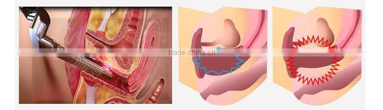 High energy CO2 Laser fractional dark circles removal skin rejuvenation machine