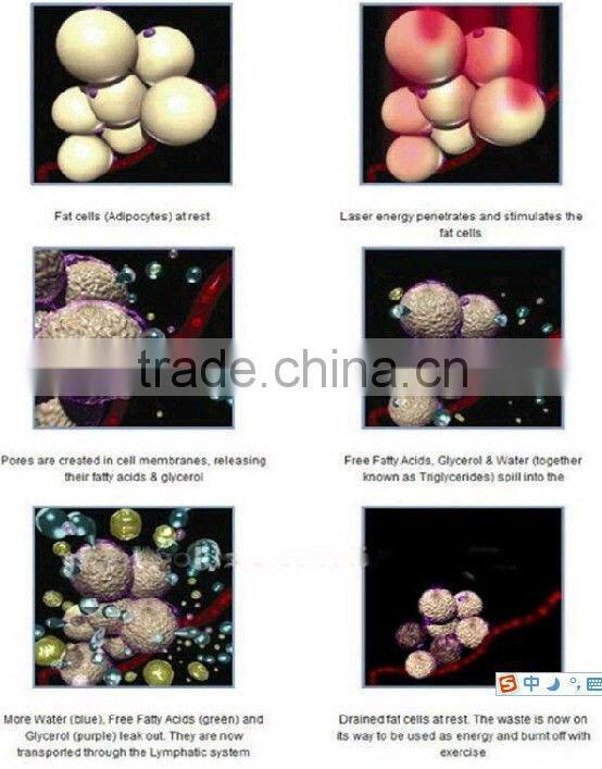 best i lipo laser machine rf vacuum cavitation slimming machine LS650