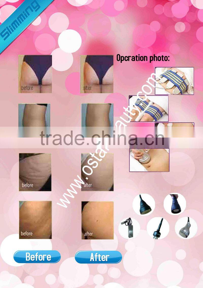 Salon slimming liposuction ultrasound therapy machine OB-S 01