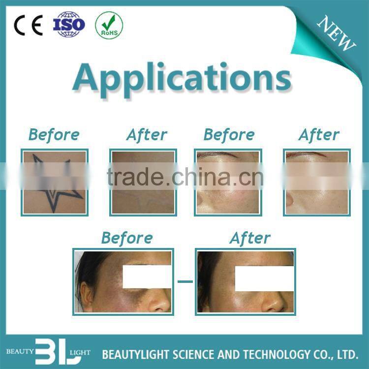 YAG laser colored eyebrow removal