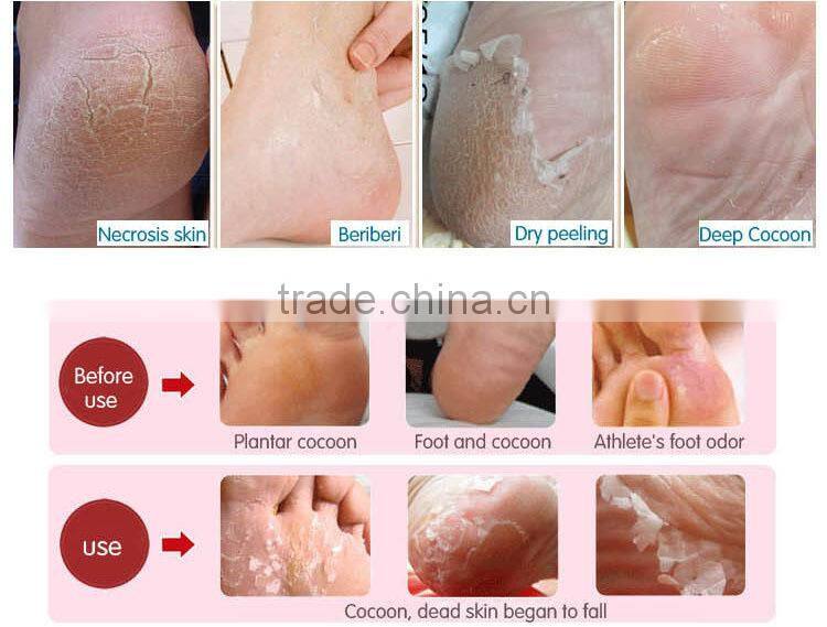 Whitening Moisturizing Dead Skin Remove Foot Care Peeling Mask