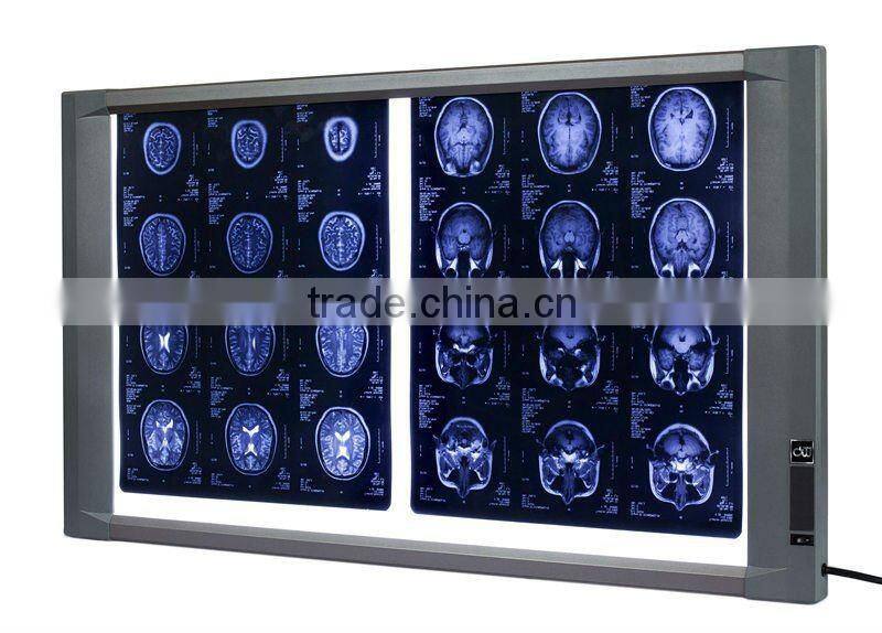 Digital x ray film reader