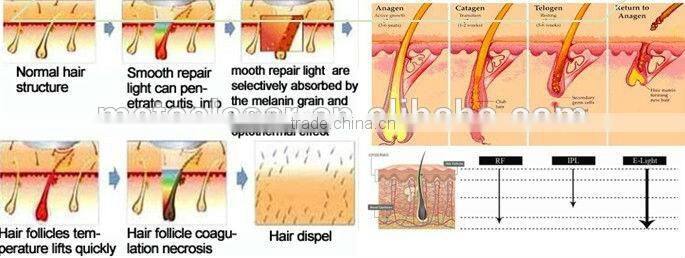 Newest Skin Tightening Face Lifting RF Machine