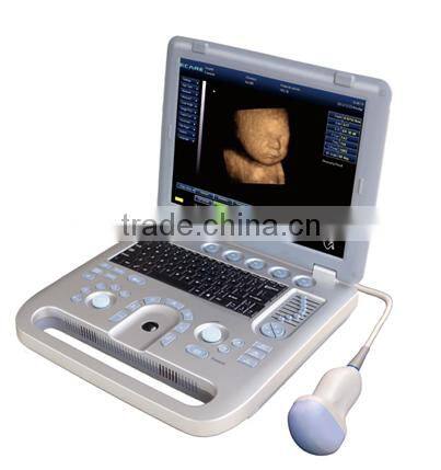 MCB-E5B 15in LCD Digital Laptop Ultrasound Scanner