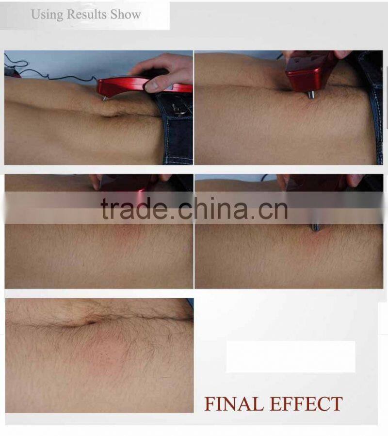 2014 NEW NO!NO! Personal Beauty Care Laser American Diode Hair Removal for Lady