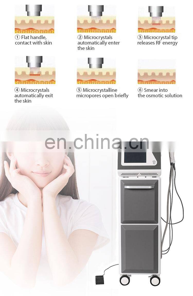 Renlang Microcrystal Technology RF Insulation Microneedle Acne Removal Cold Hammer Skin Care